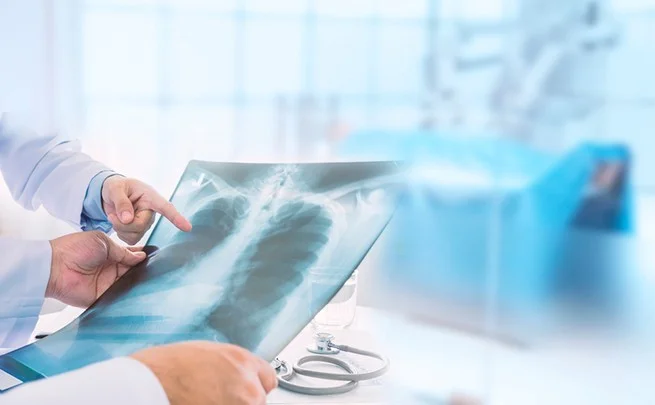 Санаторно-курортное лечение при туберкулезе