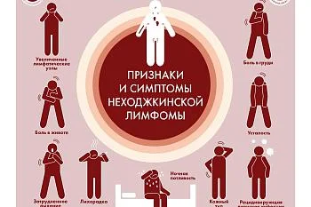 НЕХОДЖКИНСКАЯ ЛИМФОМА. Признаки и симптомы.